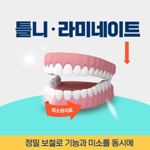 서귀포치과 서귀포시 치과 틀니 라미네이트