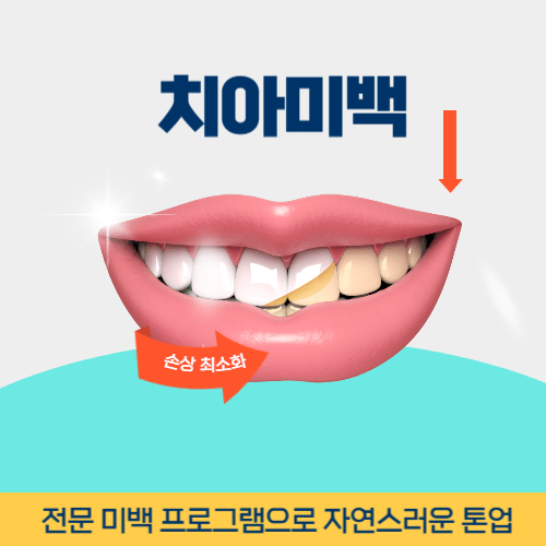 서귀포치과 서귀포시 치과 치아미백