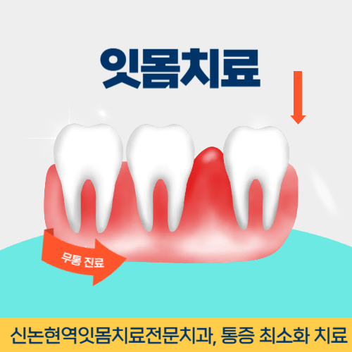 서귀포치과 서귀포시 치과 잇몸치료